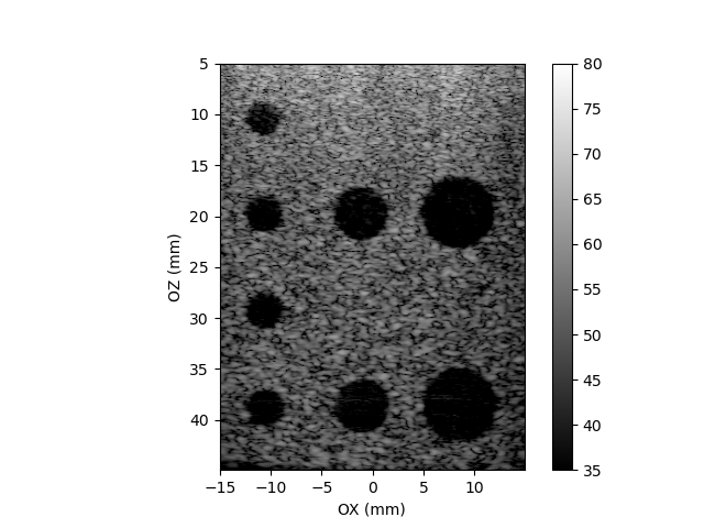 ../_images/pwi-cysts.png